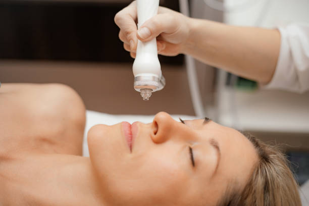 HydraFacial for acne and aging skin